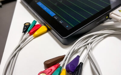 Elettrocardiogramma (ECG): Nuovo Servizio Disponibile presso il Centro Diagnostico San Marco