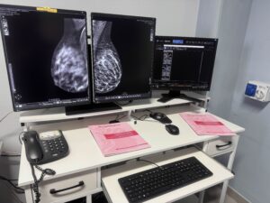 Sala mammografia Centro Diagnostico e Radiologico San Marco Cellino San Marco Brindisi